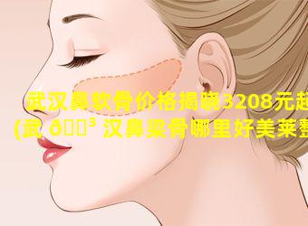 武汉鼻软骨价格揭晓3208元起(武 🐳 汉鼻梁骨哪里好美莱整形)